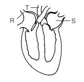 otot jantung pada dinding bilik kiri lebih tebal dibandingkan pada dinding bilik kanan