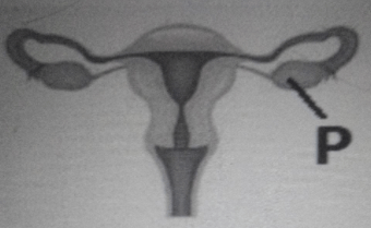 Perhatikan Gambar Berikut Organ Yang Ditunjuk Roboguru