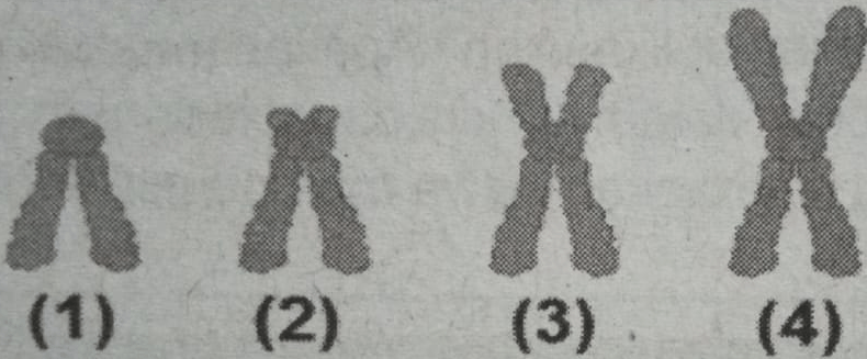 Perhatikan Gambar Berikut Tipe Kromosom Telose